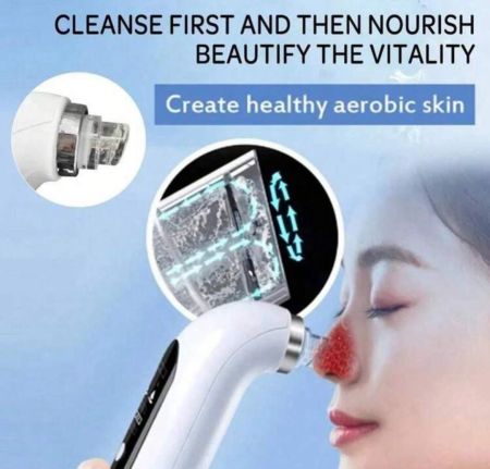 آداة إزالة الرؤوس السوداء، شفاط منافذ الوجه الكهربائي، منظف المسام، آداة تنظيف الوجه بالدورة المائية بالشحن عبر USB، سعة البطارية: 300 ملي أمبير